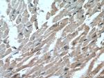 GLUT4 Antibody in Immunohistochemistry (Paraffin) (IHC (P))