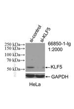 KLF5 Antibody in Western Blot (WB)
