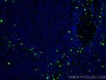 S100A8 Antibody in Immunohistochemistry (Paraffin) (IHC (P))