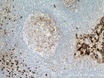 S100A8 Antibody in Immunohistochemistry (Paraffin) (IHC (P))