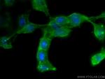 Phospho-RIPK1 (Ser161) Antibody in Immunocytochemistry (ICC/IF)