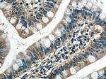 Phospho-RIPK1 (Ser161) Antibody in Immunohistochemistry (Paraffin) (IHC (P))