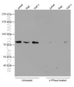 Phospho-RIPK1 (Ser161) Antibody in Western Blot (WB)
