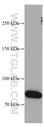 IL-6R Antibody in Western Blot (WB)