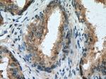 SPON2 Antibody in Immunohistochemistry (Paraffin) (IHC (P))