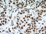 Phospho-Histone H3 (Ser10) Antibody in Immunohistochemistry (Paraffin) (IHC (P))
