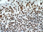 Phospho-Histone H3 (Ser10) Antibody in Immunohistochemistry (Paraffin) (IHC (P))