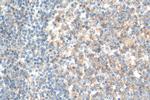 CD81 Antibody in Immunohistochemistry (Paraffin) (IHC (P))
