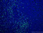 CD8 Antibody in Immunohistochemistry (Paraffin) (IHC (P))