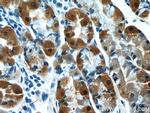 Annexin A10 Antibody in Immunohistochemistry (Paraffin) (IHC (P))