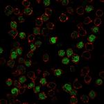 PU.1 (SPI-1) Monoclonal Antibody (PU1, 2146)