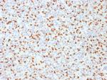 PU.1 (SPI-1) Antibody in Immunohistochemistry (Paraffin) (IHC (P))