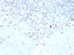 PU.1 (SPI-1) (B-Cell Marker) Antibody in Immunohistochemistry (Paraffin) (IHC (P))