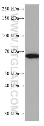 TRIM45 Antibody in Western Blot (WB)