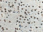 Glucocorticoid receptor Antibody in Immunohistochemistry (Paraffin) (IHC (P))