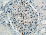 INF2 Antibody in Immunohistochemistry (Paraffin) (IHC (P))