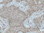TFG Antibody in Immunohistochemistry (Paraffin) (IHC (P))