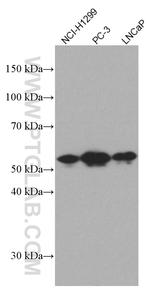 TFG Antibody in Western Blot (WB)