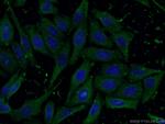 NFATC2 Antibody in Immunocytochemistry (ICC/IF)
