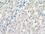 NFKB2 Antibody in Immunohistochemistry (Paraffin) (IHC (P))