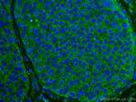 ROR1 Antibody in Immunohistochemistry (Paraffin) (IHC (P))