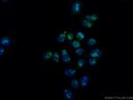 DDX21 Antibody in Immunocytochemistry (ICC/IF)