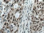 DDX21 Antibody in Immunohistochemistry (Paraffin) (IHC (P))