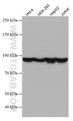 DDX21 Antibody in Western Blot (WB)