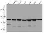 DDX21 Antibody in Western Blot (WB)