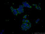 GPNMB Antibody in Immunocytochemistry (ICC/IF)