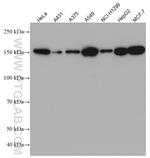CFTR Antibody in Western Blot (WB)