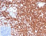CD43 (T-Cell Marker) Antibody in Immunohistochemistry (Paraffin) (IHC (P))