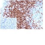 CD43 (T-Cell Marker) Antibody in Immunohistochemistry (Paraffin) (IHC (P))
