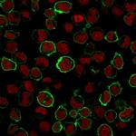 CD43 Recombinant Rabbit Monoclonal Antibody (SPN, 1766R)