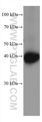 Kir4.1 Antibody in Western Blot (WB)