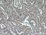 PHEX Antibody in Immunohistochemistry (Paraffin) (IHC (P))
