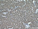 ADH1B Antibody in Immunohistochemistry (Paraffin) (IHC (P))