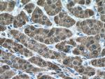 ADH1B Antibody in Immunohistochemistry (Paraffin) (IHC (P))