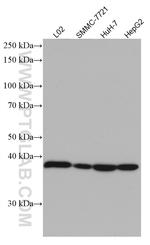 ADH1B Antibody in Western Blot (WB)