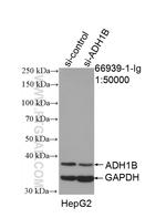 ADH1B Antibody in Western Blot (WB)
