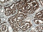 RDM1 Antibody in Immunohistochemistry (Paraffin) (IHC (P))