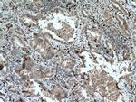 RAB27B Antibody in Immunohistochemistry (Paraffin) (IHC (P))