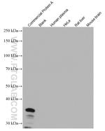 Protein A Antibody in Western Blot (WB)