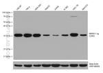 CDK4 Antibody in Western Blot (WB)