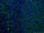 CD40 Antibody in Immunohistochemistry (Paraffin) (IHC (P))