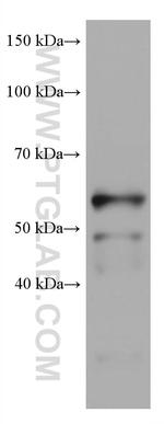 IKZF1 Antibody in Western Blot (WB)