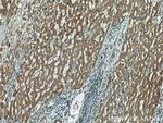 DOCK2 Antibody in Immunohistochemistry (Paraffin) (IHC (P))