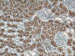 FTCD Antibody in Immunohistochemistry (Paraffin) (IHC (P))