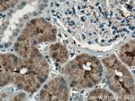 FTCD Antibody in Immunohistochemistry (Paraffin) (IHC (P))