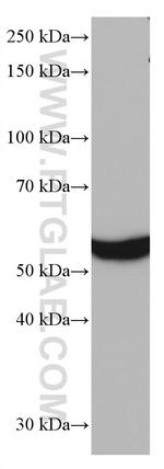FTCD Antibody in Western Blot (WB)